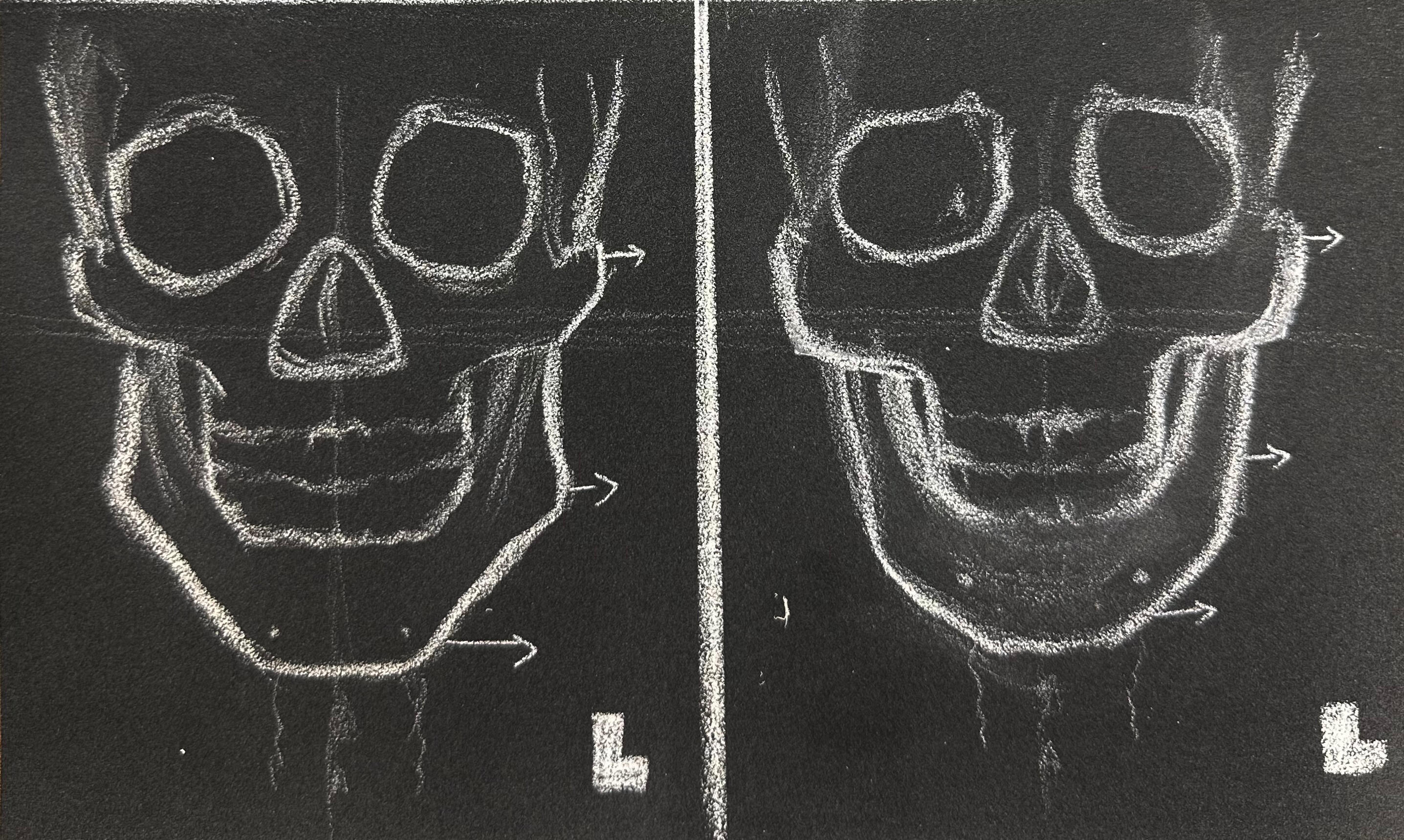 Cold Files: John Doe vs Jane Doe (Part 2) | White Pencil on Pastel Mat | 2025: A peek at some bony differences